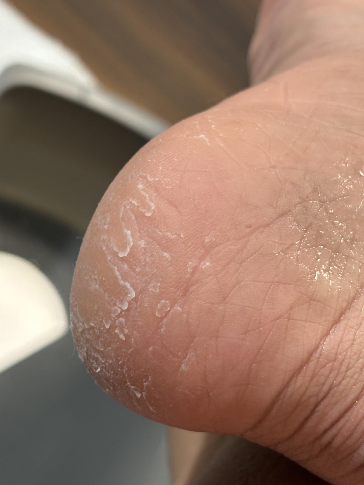 Lee Beauty 8oz Professional Gel Callus Remover for Feet - Original Fast-Acting Formula, Extra Strength for Cracked Heels & Dead Skin (Pack of 1) customer photo 2